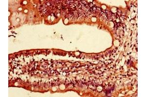 Immunohistochemistry of paraffin-embedded human small intestine tissue using ABIN7158670 at dilution of 1:100 (LYRM2 anticorps  (AA 1-88))