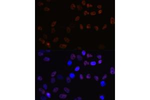 Immunofluorescence analysis of HeLa cells using MCM7 Rabbit mAb (ABIN7268544) at dilution of 1:100 (40x lens).