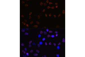 Immunofluorescence analysis of HeLa cells using MCM7 Rabbit mAb (ABIN7268544) at dilution of 1:100 (40x lens). (MCM7 anticorps)