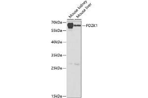 Western blot analysis of extracts of various cell lines, using PDZK1 antibody (ABIN6128428, ABIN6145422, ABIN6145423 and ABIN6220948) at 1:1000 dilution. (PDZK1 anticorps  (AA 1-260))