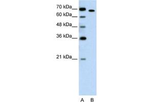 Western Blotting (WB) image for anti-RAR-Related Orphan Receptor A (RORA) antibody (ABIN2462864) (RORA anticorps)