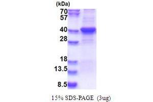 SDS-PAGE (SDS) image for Lipase, Endothelial (LIPG) (AA 21-340) protein (His tag) (ABIN5853633)