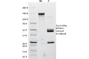SDS-PAGE Analysis Purified P-Cadherin Mouse Monoclonal Antibody (12H6). (P-Cadherin anticorps)