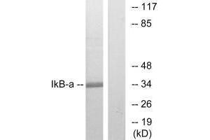 Western blot analysis of extracts from MCF7 cells, treated with TNF-α, using IkappaB-alpha (Ab-32/36) antibody.
