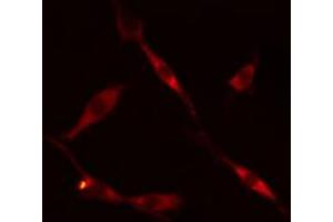 ABIN6269205 staining 293 cells by IF/ICC. (SHC1 anticorps)