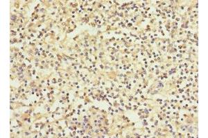 Immunohistochemistry of paraffin-embedded human spleen tissue using ABIN7166279 at dilution of 1:100 (WFDC11 anticorps  (AA 26-87))