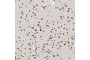 Immunohistochemical staining of human cerebral cortex with NUP153 polyclonal antibody  shows strong nuclear membranous positivity in neuronal cells. (NUP153 anticorps)