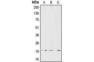 Western blot analysis of CD3d expression in CCRFCEM (A), Jurkat (B), HuT78 (C) whole cell lysates. (CD3D anticorps  (Center))