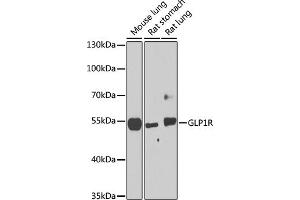 Western blot analysis of extracts of various cell lines, using GLP1R antibody (ABIN6131006, ABIN6141138, ABIN6141140 and ABIN6224643) at 1:1000 dilution. (GLP1R anticorps  (AA 22-116))