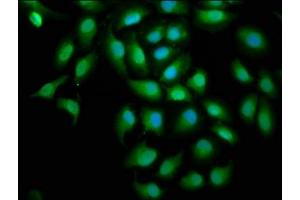 Immunofluorescence staining of A549 cells with ABIN7170778 at 1:100, counter-stained with DAPI.