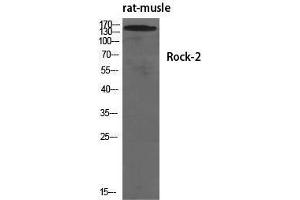 Western Blotting (WB) image for anti-rho-Associated, Coiled-Coil Containing Protein Kinase 2 (ROCK2) (Tyr466) antibody (ABIN3177290) (ROCK2 anticorps  (Tyr466))