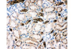 Anti-SLC12A1 antibody, IHC(F) IHC(F): Rat Kidney Tissue (SLC12A1 anticorps  (N-Term))