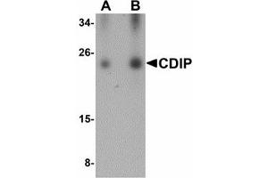 Image no. 1 for anti-LITAF-Like Protein (CDIP1) (Internal Region) antibody (ABIN478045) (CDIP1 anticorps  (Internal Region))