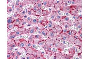 Immunohistochemistry (IHC) image for anti-Cadherin 1, Type 1, E-Cadherin (Epithelial) (CDH1) (Middle Region) antibody (ABIN2784498)