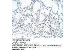 anti-Zinc Finger Protein 580 (ZNF580) (N-Term) antibody