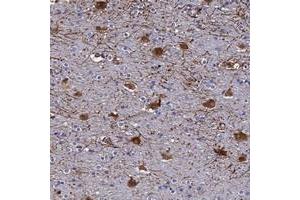 Immunohistochemical staining of human cerebral cortex with SYT13 polyclonal antibody  shows strong cytoplasmic positivity in neuronal cells at 1:50-1:200 dilution. (SYT13 anticorps)