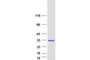 Validation with Western Blot