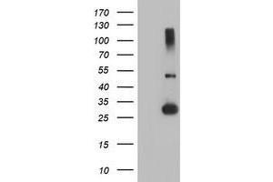 Western Blotting (WB) image for anti-Regulatory Factor X-Associated Ankyrin Containing Protein (RFXANK) antibody (ABIN1500680) (RFXANK anticorps)