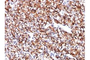 Image no. 1 for anti-Carbonic Anhydrase IX (CA9) antibody (ABIN6182201) (CA9 anticorps)