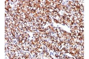 Image no. 1 for anti-Carbonic Anhydrase IX (CA9) antibody (ABIN6182201)
