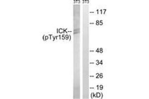 Western blot analysis of extracts from NIH-3T3 cells treated with starved 24h, using ICK (Phospho-Tyr159) Antibody. (ICK anticorps  (pTyr159))