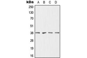 Western blot analysis of DHRS7 expression in MCF7 (A), HepG2 (B), mouse liver (C), rat liver (D) whole cell lysates. (DHRS7 anticorps  (C-Term))