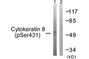 Western blot analysis of extracts from 293 cells treated with EGF 200ng/ml 30', using Keratin 8 (Phospho-Ser432) Antibody. (KRT8 anticorps  (pSer432))