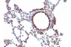 anti-Nuclear Antigen antibody