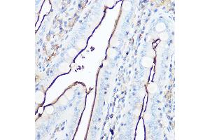 Immunohistochemistry of paraffin-embedded mouse intestin using CD13/ANPEP Rabbit pAb (ABIN6131185, ABIN6136911, ABIN6136912 and ABIN6221309) at dilution of 1:50 (40x lens). (CD13 anticorps  (AA 668-967))