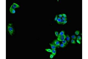 Immunofluorescent analysis of PC-3 cells using ABIN7158996 at dilution of 1:100 and Alexa Fluor 488-congugated AffiniPure Goat Anti-Rabbit IgG(H+L)