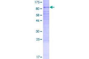Image no. 1 for Tubulin Tyrosine Ligase-Like Family, Member 2 (TTLL2) (AA 1-592) protein (GST tag) (ABIN1324065)