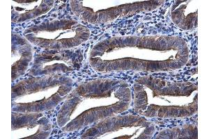 IHC-P Image SYK antibody [N2C2], Internal detects SYK protein at cytoplasm in human endometrium by immunohistochemical analysis.
