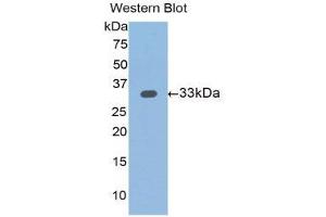 Western Blotting (WB) image for anti-Slit Homolog 1 (SLIT1) (AA 345-623) antibody (ABIN1176116)