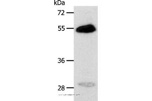 Western blot analysis of Human liver cancer tissue, using CA14 Polyclonal Antibody at dilution of 1:400
