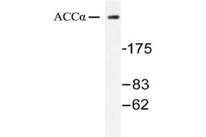Image no. 1 for anti-Acetyl-CoA Carboxylase alpha (ACACA) antibody (ABIN271866) (Acetyl-CoA Carboxylase alpha anticorps)