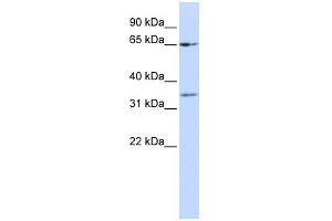 WB Suggested Anti-ZNF157 Antibody Titration:  0. (ZNF157 anticorps  (N-Term))