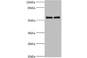 Western blot All lanes: IL7R antibody at 4 μg/mL Lane 1: K562 whole cell lysate Lane 2: Jurkat whole cell lysate Secondary Goat polyclonal to rabbit IgG at 1/10000 dilution Predicted band size: 52, 35, 30, 29 kDa Observed band size: 52 kDa (IL7R anticorps  (AA 21-239))