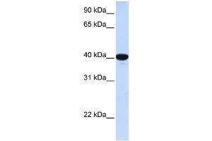 G6PC antibody used at 1 ug/ml to detect target protein.