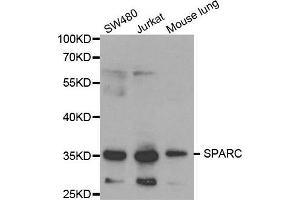 Western blot analysis of extracts of various cell lines, using SPARC antibody. (SPARC anticorps  (AA 18-303))