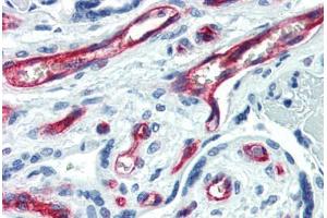 Human Placenta (formalin-fixed, paraffin-embedded) stained with CD34 antibody ABIN461990 at 1:50 followed by biotinylated anti-mouse IgG secondary antibody ABIN481714, alkaline phosphatase-streptavidin and chromogen. (CD34 anticorps  (FITC))