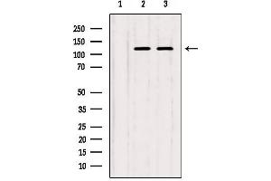 Western blot analysis of extracts from various samples, using IP3KB Antibody. (ITPKB anticorps  (Internal Region))