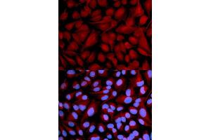 Immunofluorescence analysis of U2OS cell using CASK antibody. (CASK anticorps  (AA 1-300))