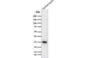Western Blot Analysis of human brain tissue lysate using Pgp9.