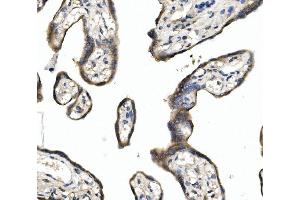 IHC analysis of DLL1 using anti-DLL1 antibody (ABIN7600324). (DLL1 anticorps  (AA 18-239))