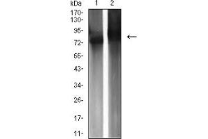 Western blot analysis using IGHM mouse mAb against Raji (1) and Ramos (2) cell lysate. (IGHM anticorps  (AA 310-452))