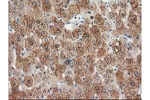 Immunohistochemical staining of paraffin-embedded Human liver tissue using anti-HDHD2 mouse monoclonal antibody. (HDHD2 anticorps)