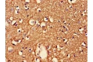 Immunohistochemistry of paraffin-embedded human brain tissue using ABIN7147230 at dilution of 1:100 (CDK5RAP2 anticorps  (Regulatory Subunit))