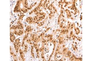 Immunohistochemistry (IHC) image for anti-Tax1 (Human T-Cell Leukemia Virus Type I) Binding Protein 1 (TAX1BP1) antibody (ABIN2824857) (TAX1BP1 anticorps)