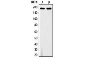 Western blot analysis of VEGFR1 (pY1213) expression in A10 (A), MDAMB231 (B) whole cell lysates. (FLT1 anticorps  (C-Term, pTyr1213))
