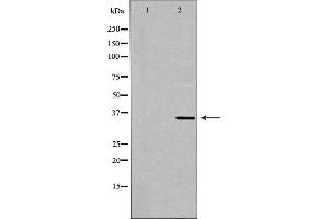 Western blot analysis of Hela whole cell lysates, using MNAT1 Antibody. (MNAT1 anticorps  (N-Term))